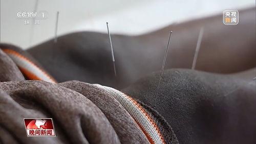 颈椎针灸视频,视频详解与实操指南