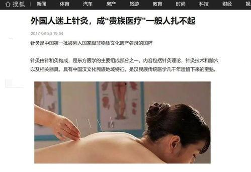 针炙视频,轻松掌握传统中医养生之道