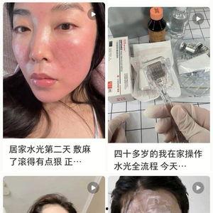微针视频,视频揭秘未来医疗创新
