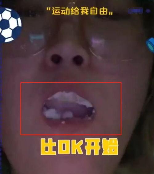 塞药视频,常见药物的正确使用方法与注意事项